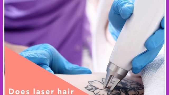 Tca Tattoo Removal – Removing A Tattoo From Your Forearm