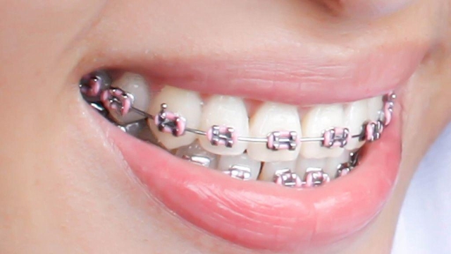 The Perks of Choosing a Private Dentist: Your Key to Personalized Oral Care